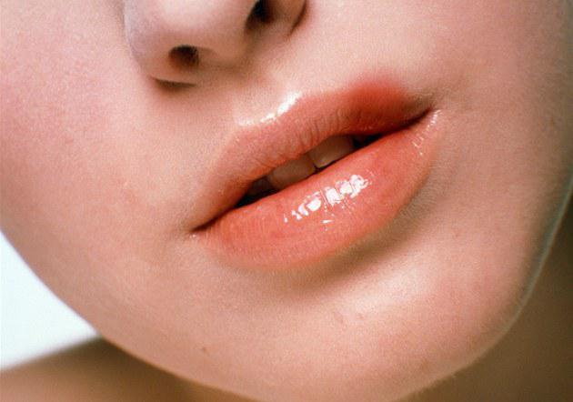 How To Get Rid Of Herpes On Lip Fast